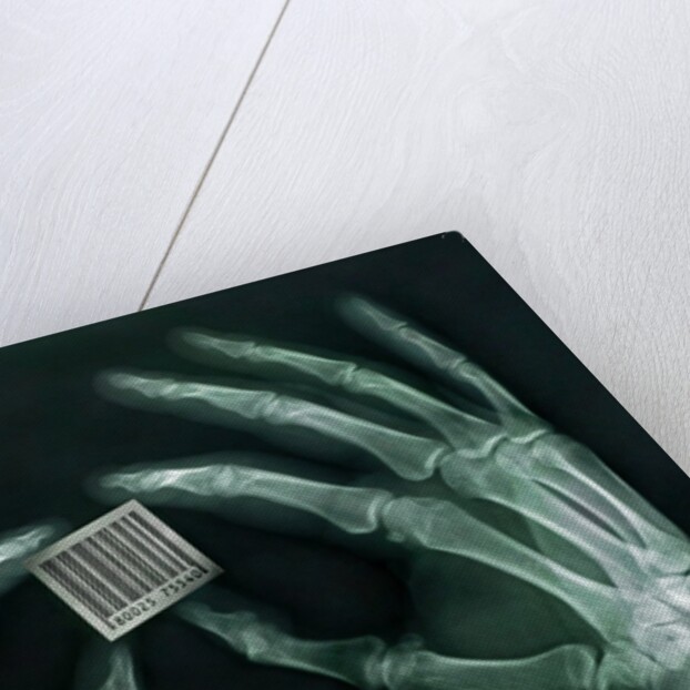 Skeletal Hands Holding Barcode by Anonymous