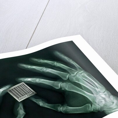 Skeletal Hands Holding Barcode by Anonymous