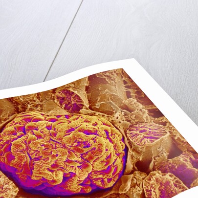 Glomerulus of kidney by Anonymous