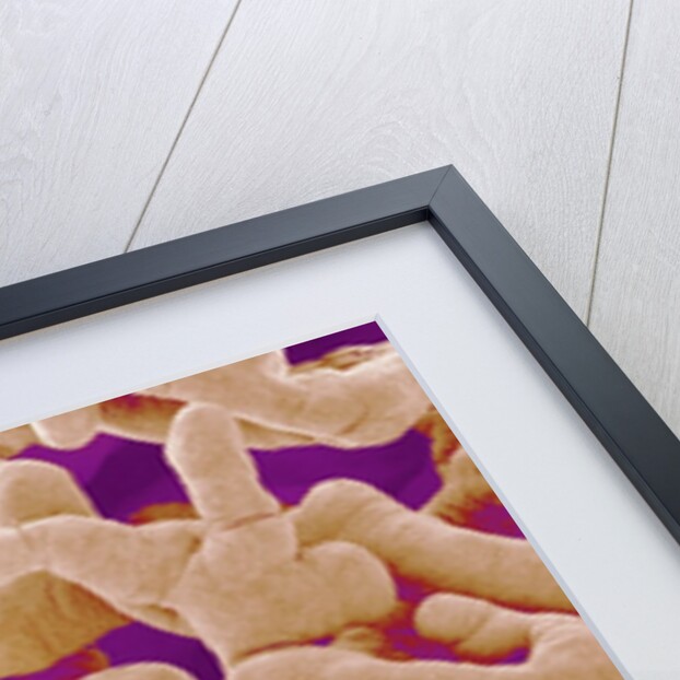 Human Placenta by Anonymous