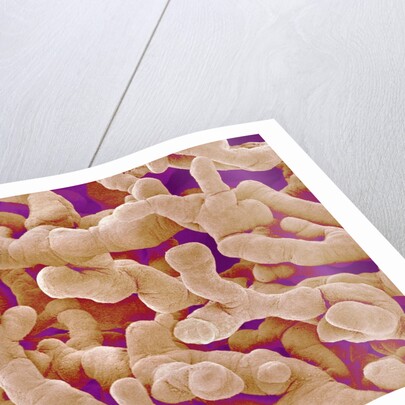 Human Placenta by Anonymous
