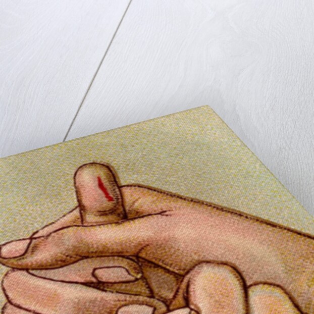 Bleeding finger by Anonymous