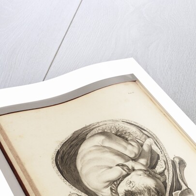 Engraving of a child in the womb by William Smellie