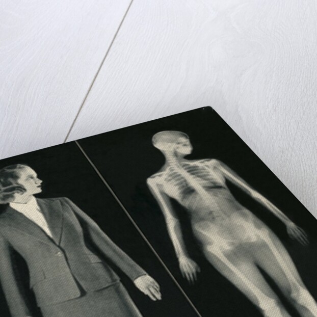 X-Rays and You by Anonymous