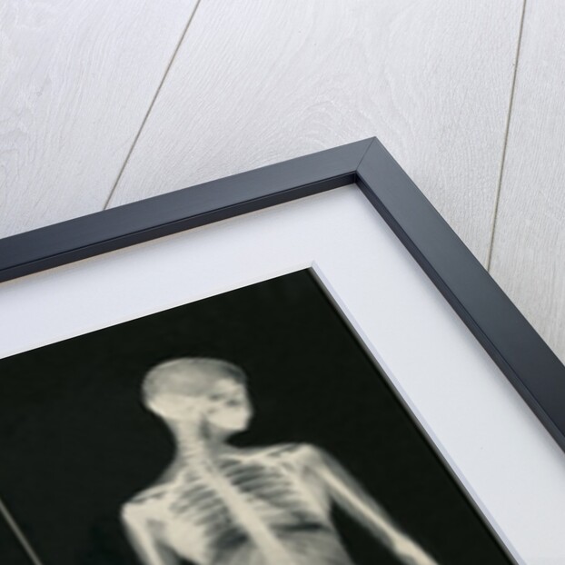 X-Rays and You by Anonymous