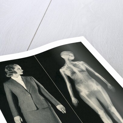 X-Rays and You by Anonymous