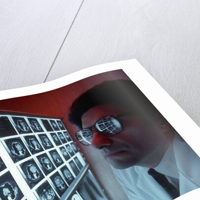 1980s doctor examining CAT scan by Anonymous