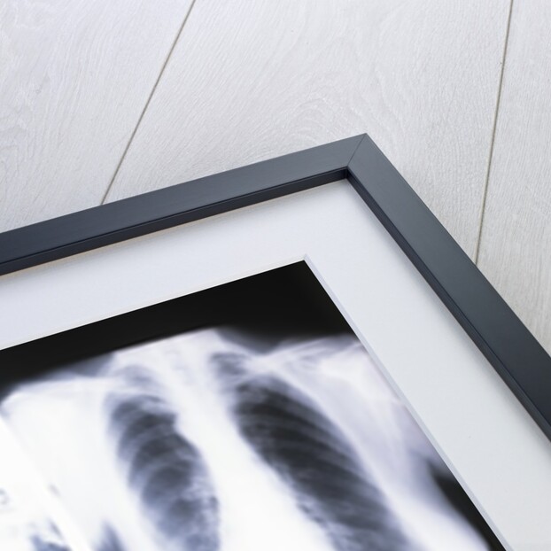 1980s doctor looking at x-ray while speaking on telephone by Anonymous