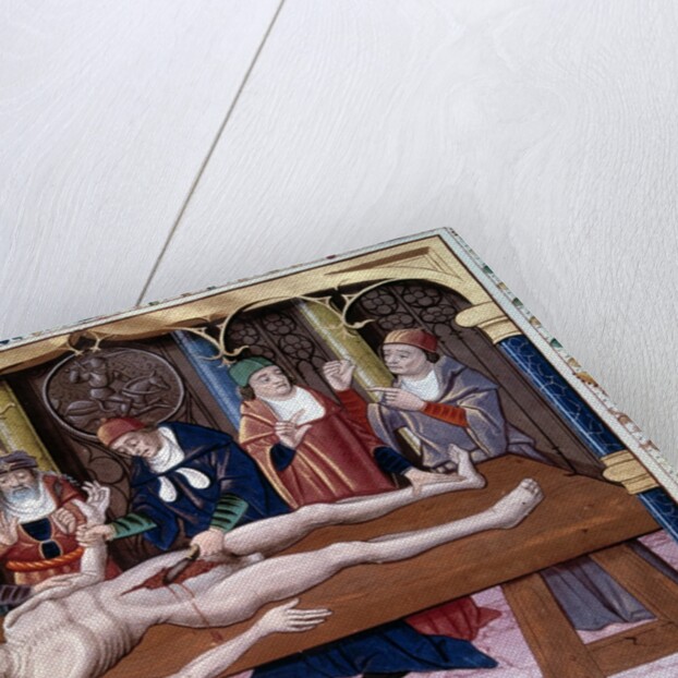 Autopsy, 15th century by Anonymous