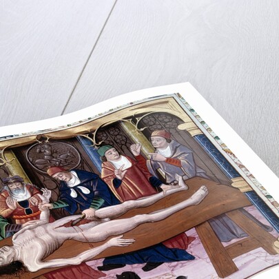 Autopsy, 15th century by Anonymous
