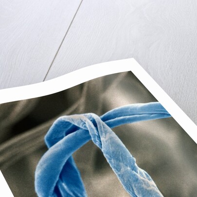 Cotton Fibers by Anonymous