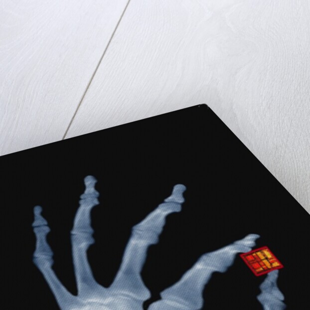Skeletal Hand Holding Computer Chip by Anonymous