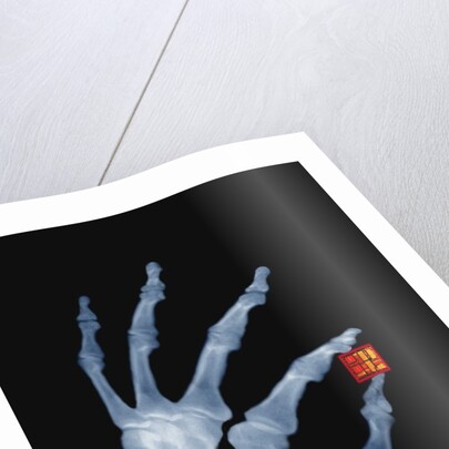 Skeletal Hand Holding Computer Chip by Anonymous