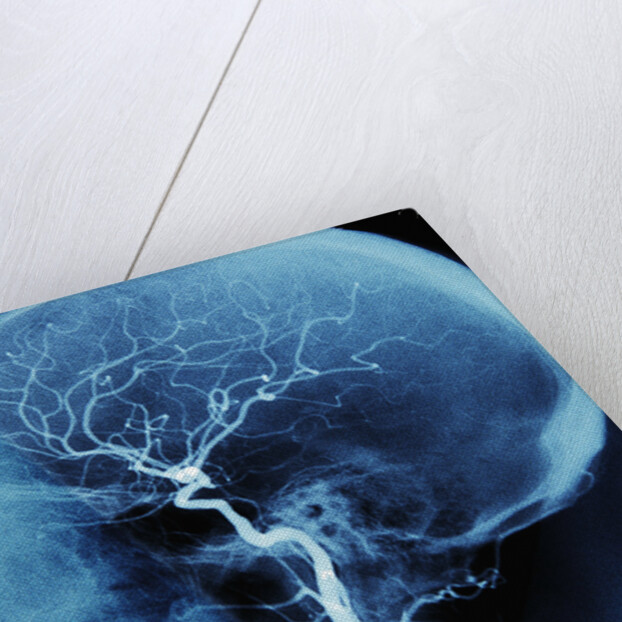 X-Ray of Human Head by Anonymous