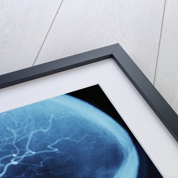 X-Ray of Human Head by Anonymous