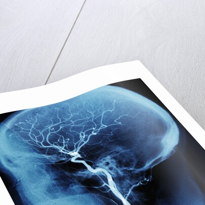 X-Ray of Human Head by Anonymous