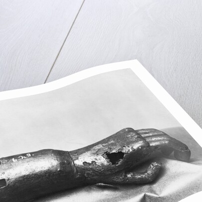 Artificial Iron Hand by Anonymous
