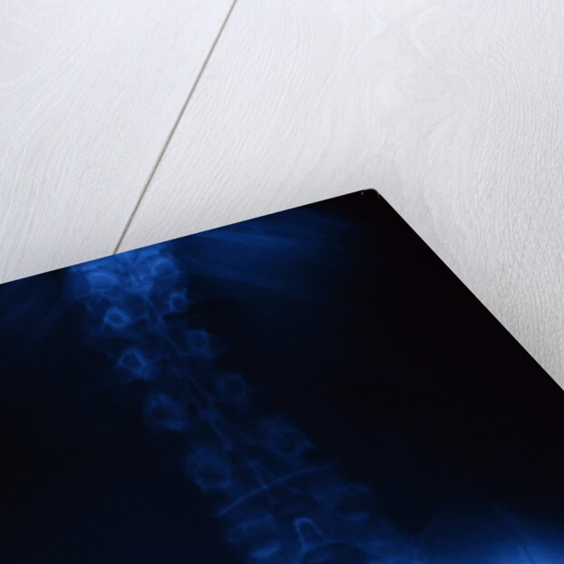 X-Ray of Human Lower Spine by Anonymous