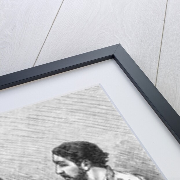 Illustration of a Woman Receiving a Blood Transfusion in February 1882 by Anonymous