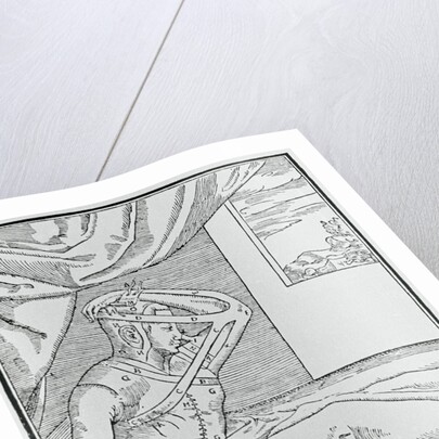 Patient with Nose Surgery by Anonymous