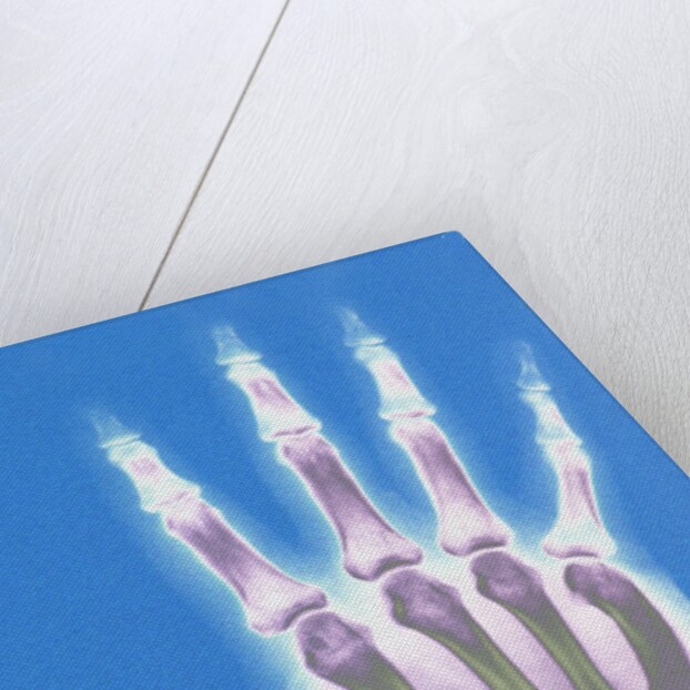 X-ray of a Hand by Anonymous