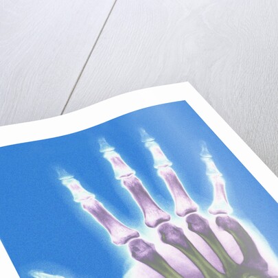 X-ray of a Hand by Anonymous