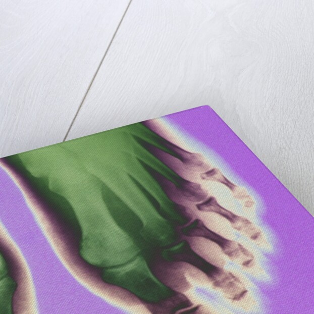 X-ray of Feet by Anonymous
