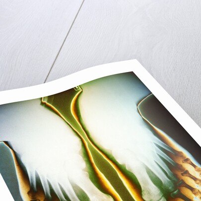 X-ray of Feet by Anonymous