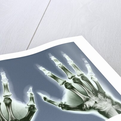 X-ray of Hands by Corbis