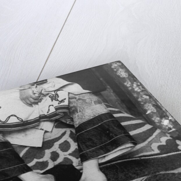 Chinese Woman Showing Emaciated Deformed Feet by Anonymous