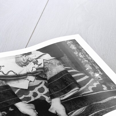 Chinese Woman Showing Emaciated Deformed Feet by Anonymous