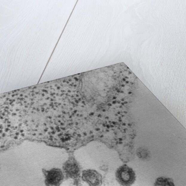 Tumors Budding from Cell Membrane by Anonymous