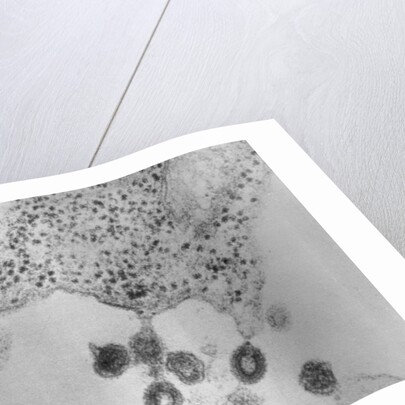 Tumors Budding from Cell Membrane by Anonymous