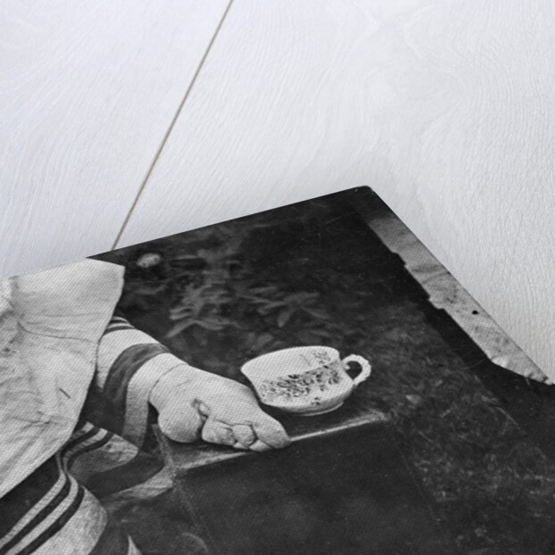 Disfigured Result of Chinese Foot Binding by Anonymous