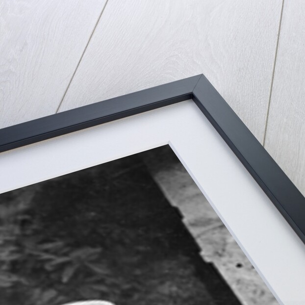 Disfigured Result of Chinese Foot Binding by Anonymous