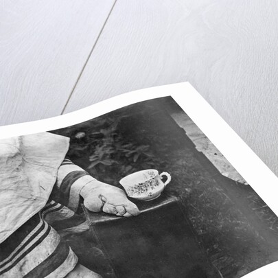 Disfigured Result of Chinese Foot Binding by Anonymous