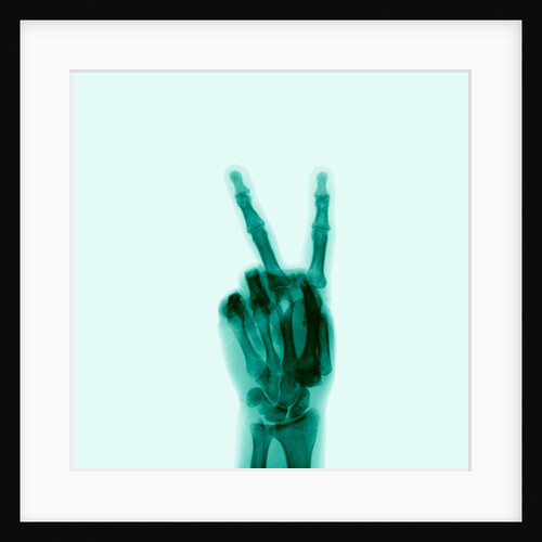 X-Ray of Hand Doing Peace Sign by Anonymous