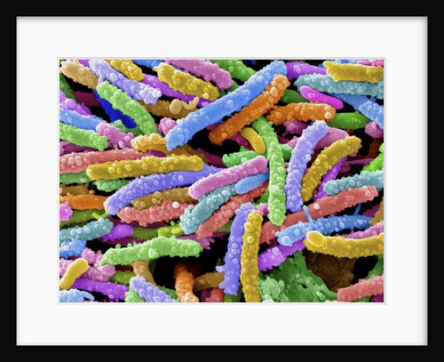 E. Coli Bacteria by Anonymous
