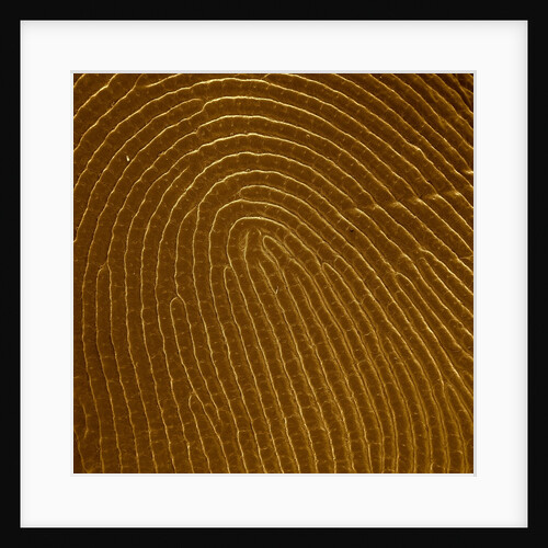 Human Fingertip by Anonymous