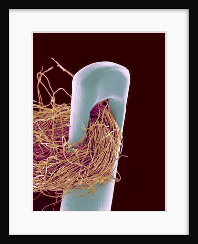 Head of Threaded Needle by Anonymous