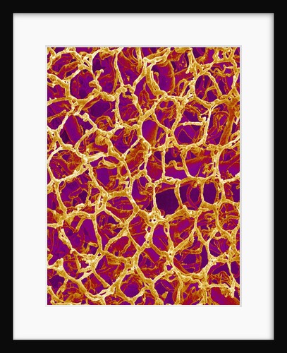 Blood Vessel Cast from Colon of a Rat by Anonymous