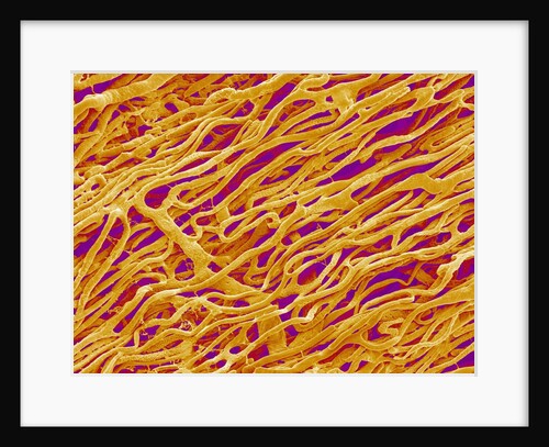 Blood Vessel Cast in Heart of a Rat by Anonymous