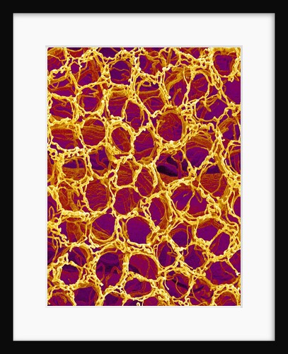 Blood Vessel Cast from Stomach of a Rat by Anonymous