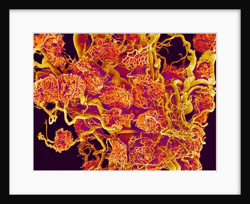 Blood Vessels and Corpus Luteum in Ovary of a Frog by Anonymous