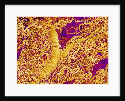 Blood Vessel Cast in Connective Tissue of a Rat by Anonymous
