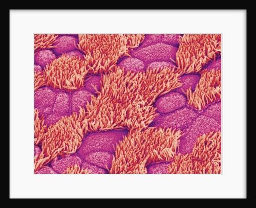 Trachea of a Rat by Anonymous