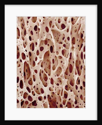 Bone Tissue by Anonymous