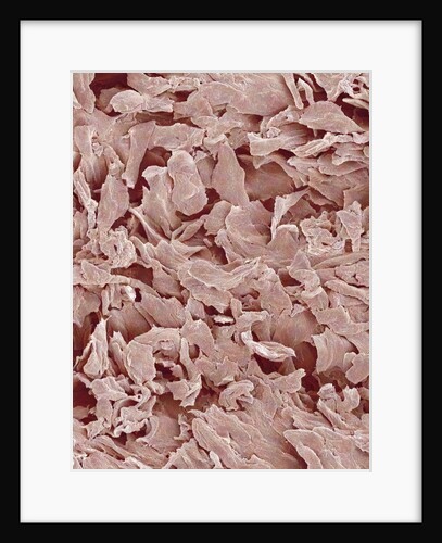 Fingernail by Anonymous