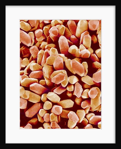 Otoliths of a Rabbit by Anonymous