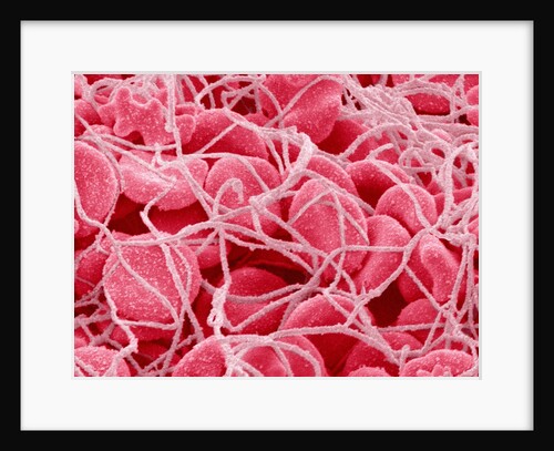 Coagulated Red Blood Cells by Anonymous